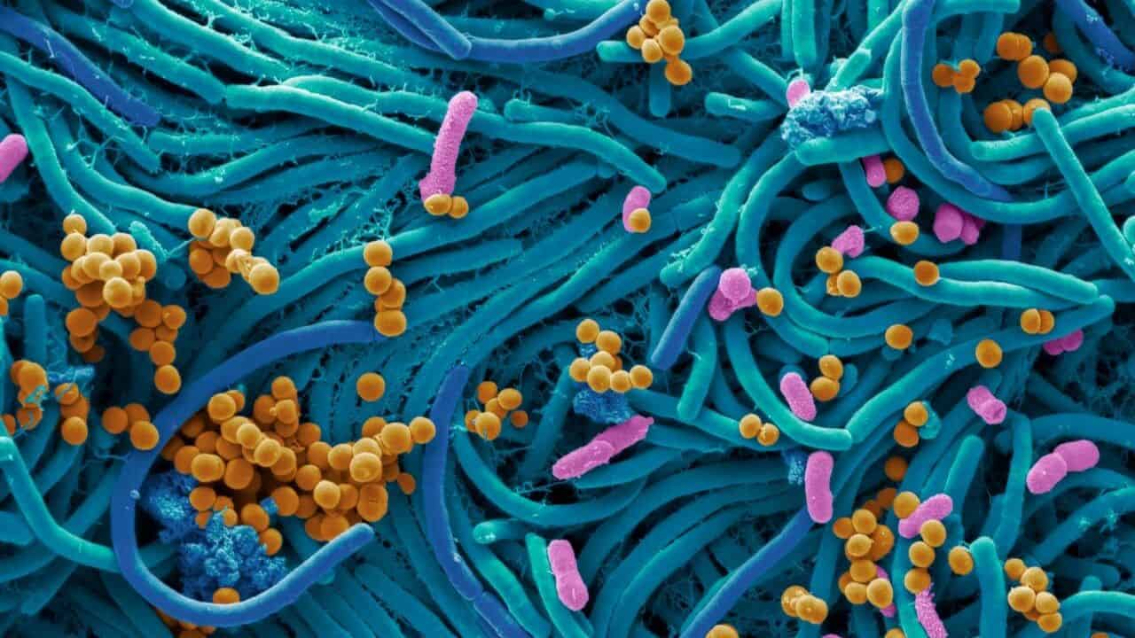 new research clarifies connection between autism and the microbiome